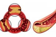 胆固醇高女性胆固醇高吃什么好