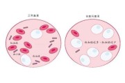 血红蛋白偏高是什么原因男性血红蛋白偏高说明了什么