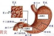 有胃炎的人能否吃南瓜？应该注意哪些事项？