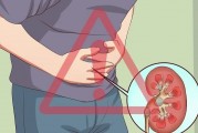 胃癌的早期症状有哪些肠胃疼