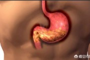 慢性胃炎怎样注意？
