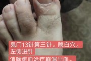 鬼门十三针对鬼的影响鬼门十三针真能治精神病吗