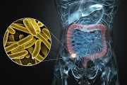肠道疾病有哪些肠道疾病