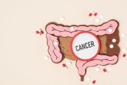 直肠癌早期症状,直肠癌早期能彻底治愈吗