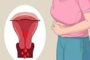 宫颈癌早期症状,宫颈有问题的前兆