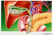 慢性胆囊炎注意事项及饮食禁忌,慢性胆囊炎