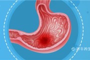 胃癌最明显的症状,胃癌最明显的症状会放屁