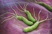 幽门螺杆菌感染会自愈吗？有什么食疗方法可以杀菌养胃吗？