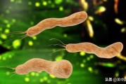 幽门螺杆菌检查是2个十幽门螺旋杆菌阳性2个严重吗