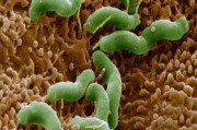 吃同一盘菜会感染幽门螺杆菌,幽门螺旋杆菌感染的原因