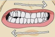睡觉磨牙有什么方法可以治脑鸣睡觉磨牙有什么方法可以治