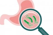 中医不建议杀幽门螺杆菌,正常人胃里都有幽门螺杆菌吗
