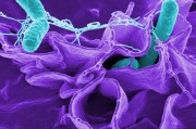 关于幽门螺旋杆菌最好的治疗方法中药能根根治的信息