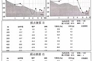 睡眠瘫痪症伴严重耳鸣吃什么药,睡眠瘫痪症伴严重耳鸣