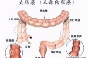 肠癌的早期症状和前兆肠癌的早期症状和前兆大便图片大全