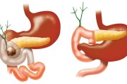十二指肠癌症状及表现,十二指肠癌
