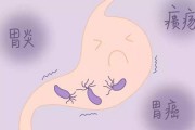 感染幽门螺杆菌什么症状的简单介绍