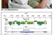 睡眠监测打鼾检测,睡眠监测打鼾检测多少钱