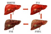 肝脏排毒,肝脏排毒功能差怎么办