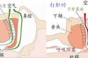 睡觉打鼾有什么治疗方法睡觉打鼾有什么治疗方法可以缓解