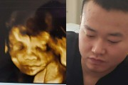 妇幼保健院四维彩超免费吗妇幼保健院四维