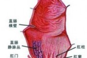 直肠炎早期的5大症状,直肠炎的症状及治疗