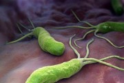 幽旋罗门杆菌有什么症状幽罗门杆菌传染多久才会表现出来