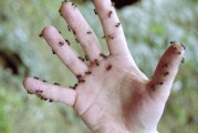 蚂蚁的保健蚂蚁的保健作用