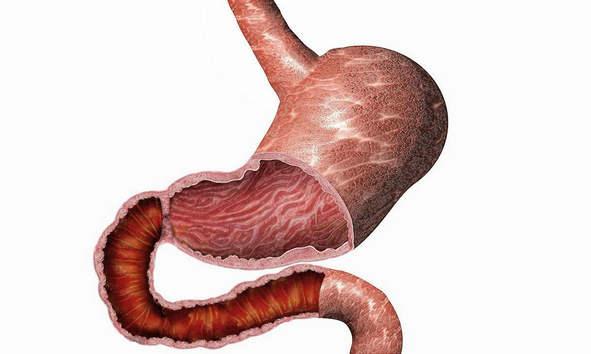 胃溃疡是种什么病<strong>胃溃疡</strong>？哪些因素会引起胃溃疡呢？