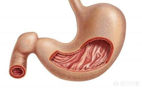 胃溃疡、十二指肠溃疡是一种很严重的病吗<strong>胃溃疡</strong>？