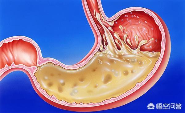 胃痛很难受<strong>胃脘痛</strong>，是什么原因？