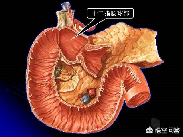 十二指肠处痛<strong>十二指肠</strong>，饭后能减轻是什么原因？