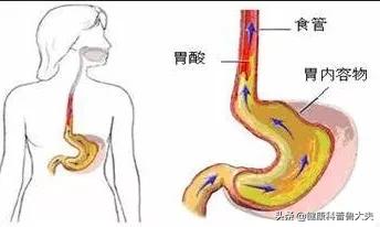 有什么建议可以推荐给有胃病的朋友<strong>胃炎</strong>？