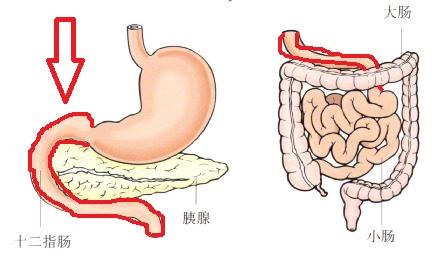 十二指肠炎有哪些症状<strong>十二指肠</strong>？