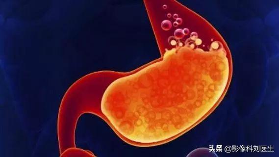 慢性胃炎分为几类<strong>胃炎</strong>？哪种危害更大？哪种会导致胃癌呢？