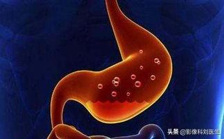 慢性胃炎分为几类<strong>胃炎</strong>？哪种危害更大？哪种会导致胃癌呢？