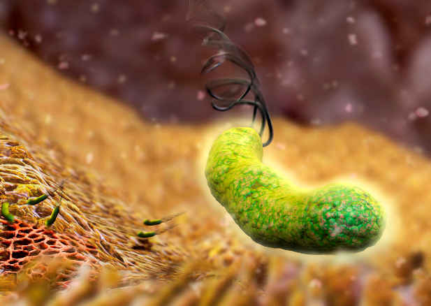 螺旋幽门杆菌的症状是什么,螺旋幽门杆菌的症状是什么病