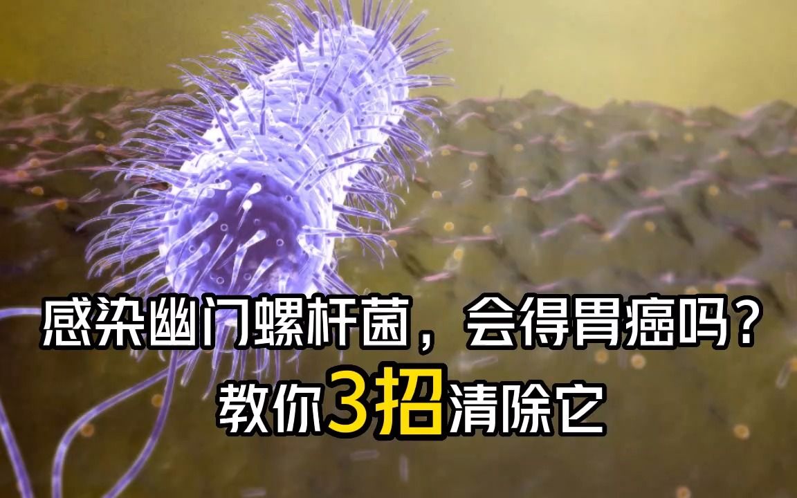 我国超一半人感染幽门螺杆菌超过一半中国人感染幽门螺杆菌 有时还未必能察觉