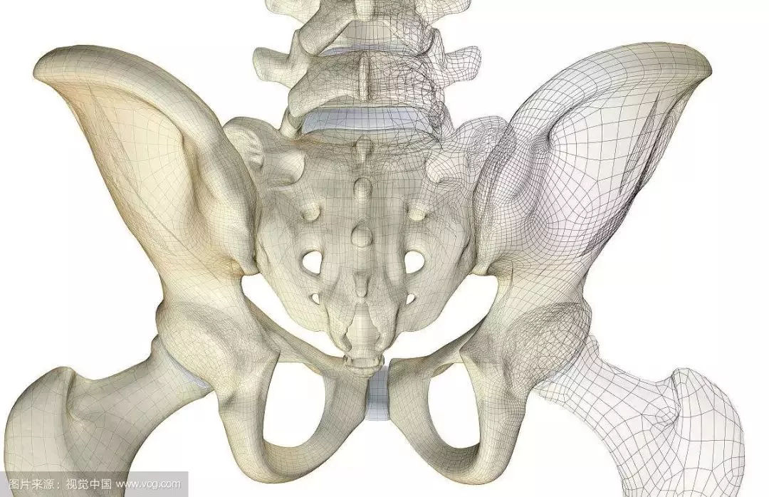 骨盆,骨盆倾斜导致脊柱侧弯 能矫正过来吗