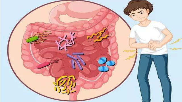 肠易激综合征,肠易激综合征的最佳治疗方案