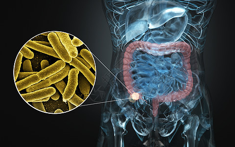 肠道疾病有哪些肠道疾病