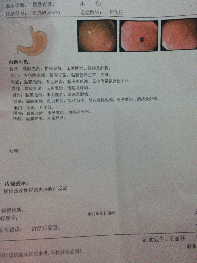 慢性胃窦炎伴糜烂应该怎么样治疗,慢性胃窦炎