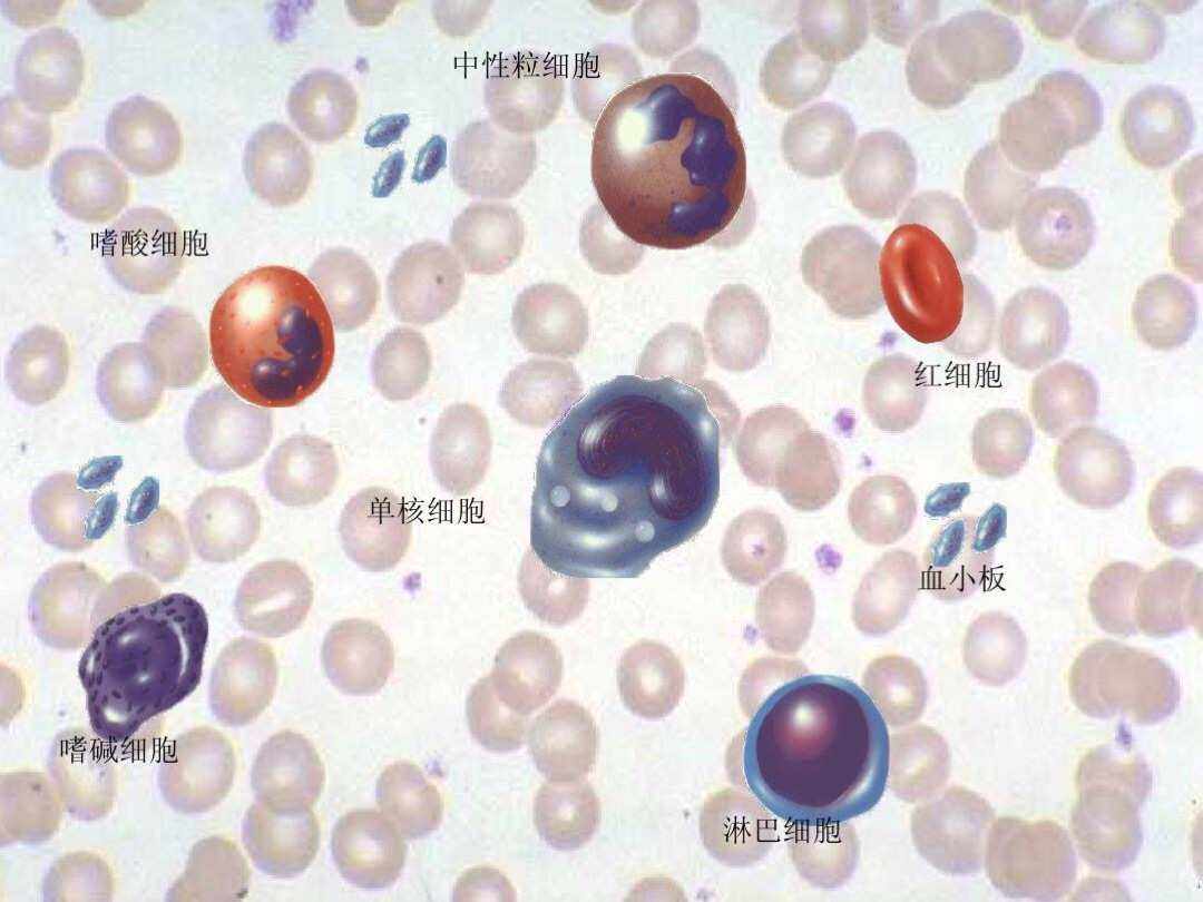红细胞分布宽度红细胞分布宽度偏低