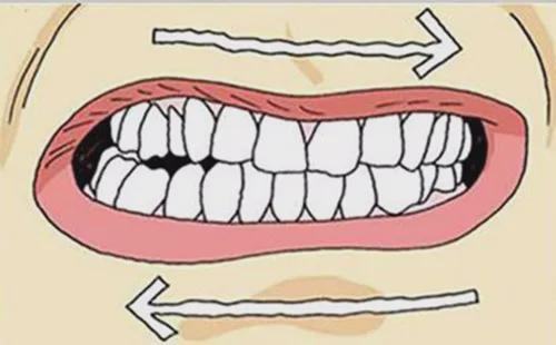 睡觉磨牙有什么方法可以治脑鸣睡觉磨牙有什么方法可以治