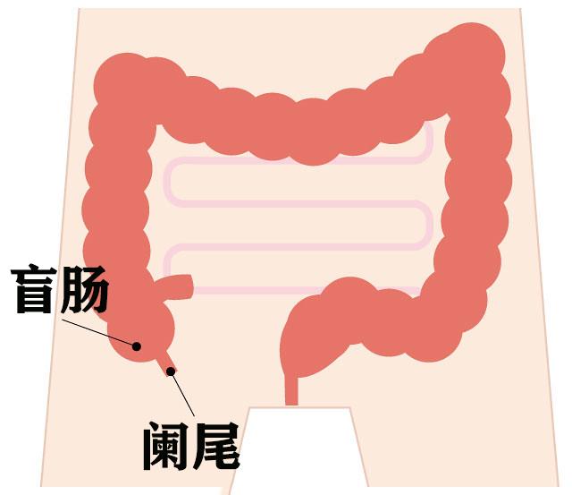 阑尾炎是哪个部位疼位置图片阑尾炎是哪个部位疼位置图