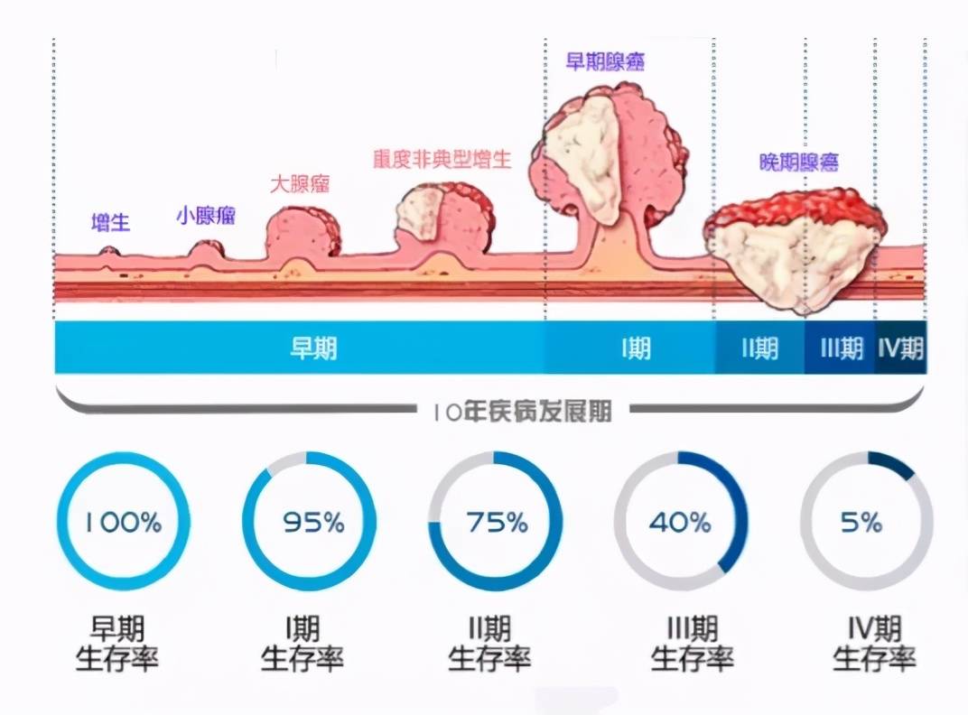 肠息肉的症状表现,肠息肉的症状表现有哪些