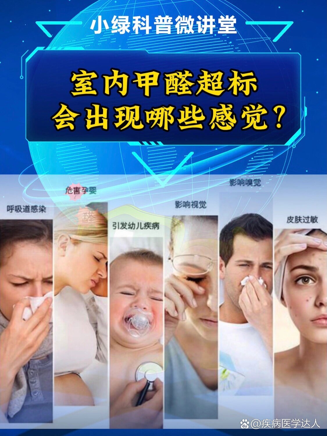 房子里甲醛超标会出现什么症状甲醛超标会出现什么症状