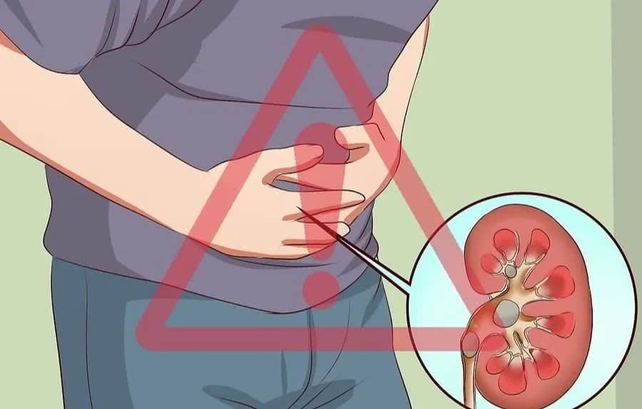胃癌的早期症状有哪些肠胃疼