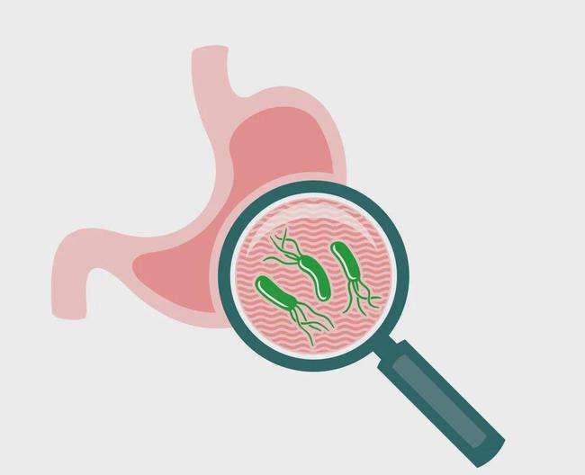 幽门螺杆菌弱阳性可以治愈吗,幽门螺旋杆菌阳性好治疗吗