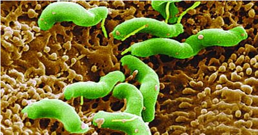 幽门螺旋杆菌如何感染的慢性胃炎的症状表现有哪些